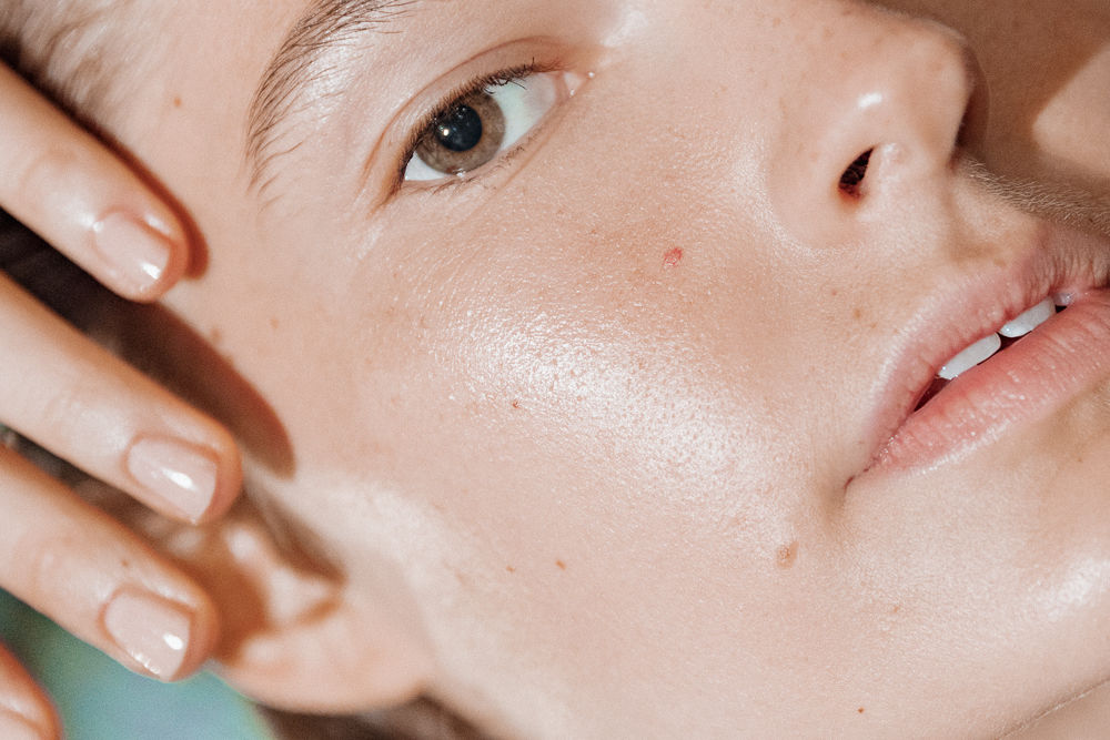 How to Get Rid of Oily Skin Forever